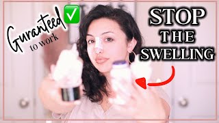REDUCE SWELLING DRASTICALLY AFTER RHINOPLASTY (OR ANY SURGERY) + HOW I TAPE MY NOSE