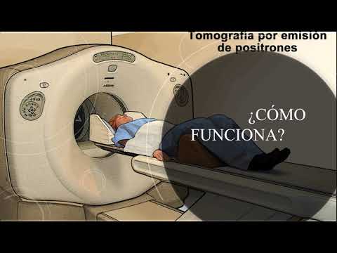 Vídeo: Tomografía Por Emisión De Positrones Dirigida Al Receptor De Folato De Encefalomielitis Autoinmune Experimental En Ratas