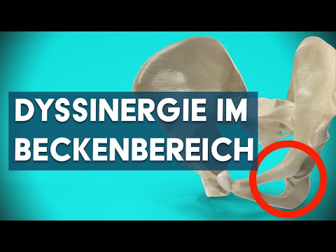 Was ist eine Beckenbodendyssinergie (Anismus)? Dr. Eduard Karsten klärt auf