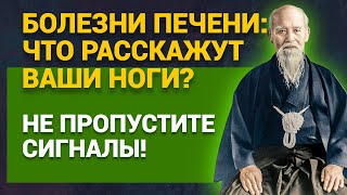 видео: Болезни печени: что расскажут ваши ноги? Не пропустите сигналы! картинка: Болезни печени: что расскажут ваши ноги? Не пропустите сигналы!