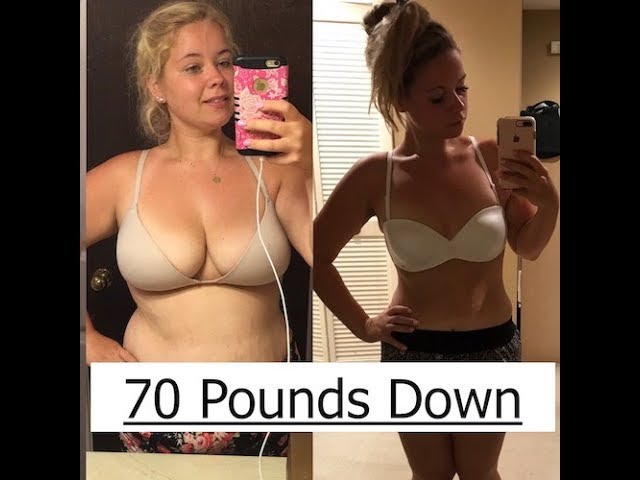 70 Pound Weight Loss Before and After 