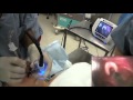 GlideScope Pediatric Airway Rounds Case Study:13 month old, Inguinal Hernia Repair