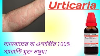 Urticaria Homeopathic Medicine In Bengali। Skin Allergy Homeopathic Medicine।