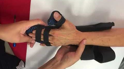 SaeboStretch Hand Splint Fitting
