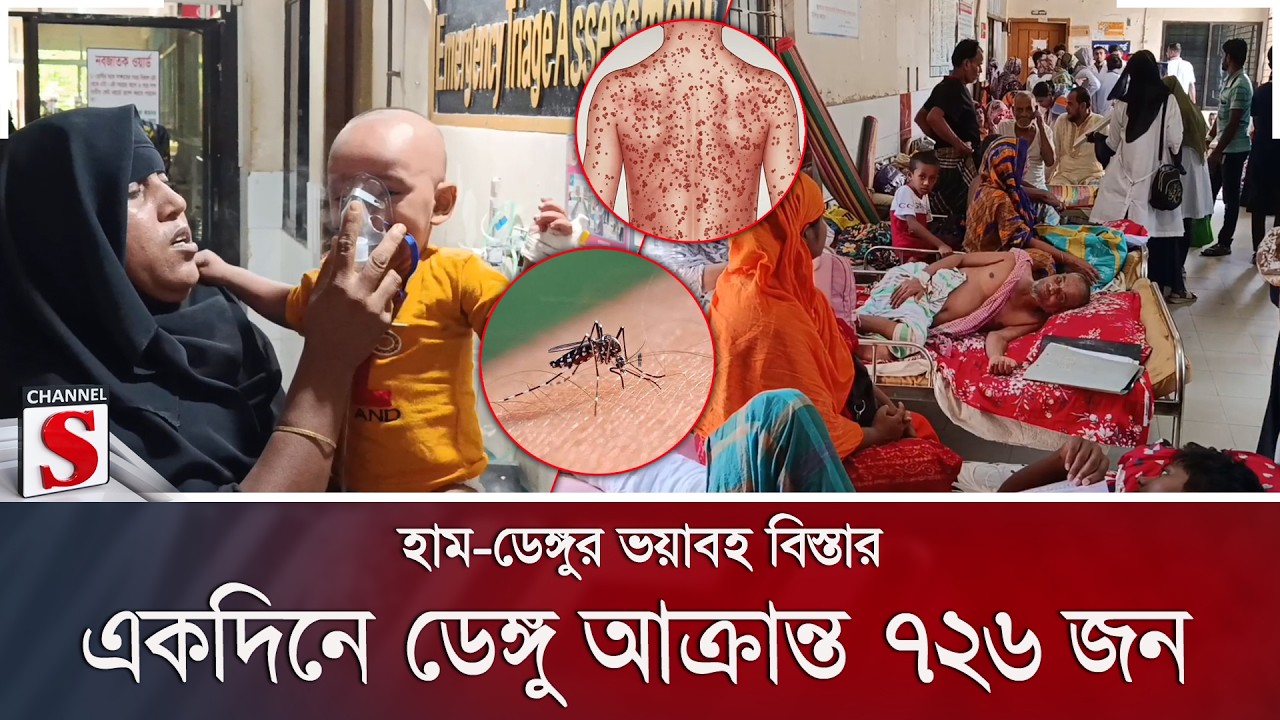হাম-ডেঙ্গুর ভয়াবহ বিস্তার; একদিনে ডেঙ্গু আক্রান্ত ৭২৬ জন | Measles | Dengue | Channel S News