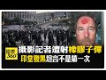 正中前額! 美國攝影記者採訪遭擊中橡皮子彈 目睹Waymo自駕車遭縱火 【國際360】20250611@全球大視野Global_Vision