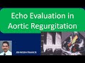 Echo Evaluation in Aortic Regurgitation