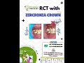 💎🦷 𝐁𝐞𝐟𝐨𝐫𝐞 ➡️ 𝐀𝐟𝐭𝐞𝐫 | 𝐏𝐚𝐢𝐧-𝐅𝐫𝐞𝐞 𝐒𝐦𝐢𝐥𝐞 𝐓𝐫𝐚𝐧𝐬𝐟𝐨𝐫𝐦𝐚𝐭𝐢𝐨𝐧 𝐚𝐭 𝐃𝐫. 𝐍𝐞𝐞𝐦𝐳 𝐃𝐞𝐧𝐭𝐢𝐬𝐭𝐫𝐲⚡