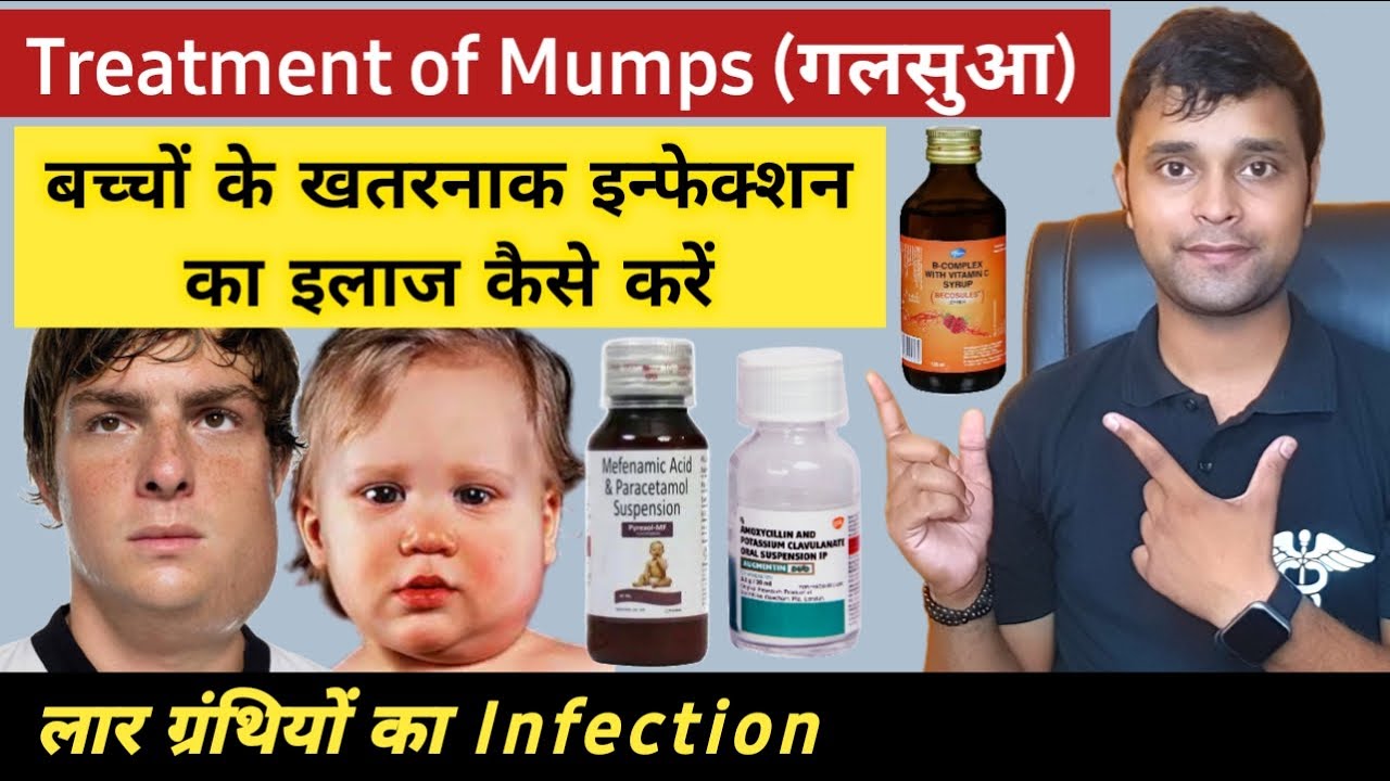 Treatment of viral infections mumps treatment in hindi Treatment of