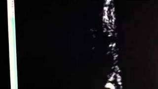 openFrameworks boids test #1 Net Worth