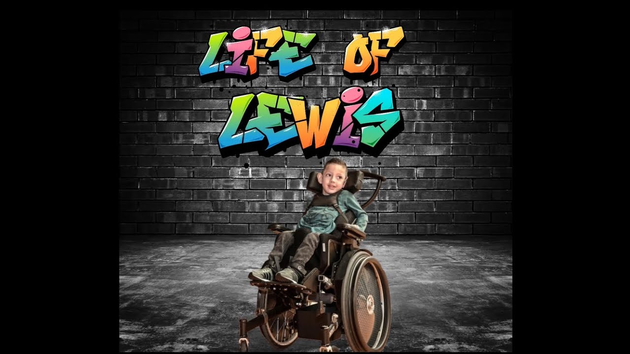 we hebben lang moeten wachten voor deze operatie maar nu is het dan eindelijk zover  #20