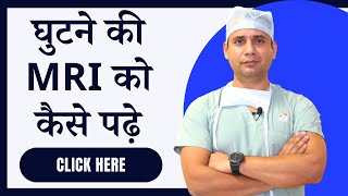 घुटने की m.r.i. को घर पर कैसे समझें आसान भाषा में हिंदी में/ghar par mri kaise padhe/