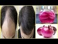 सिर्फ 21 दिनों में प्याज के रस से बालों को Regrowth करे | Onion Juice For Hair Loss & Hair Regrowth