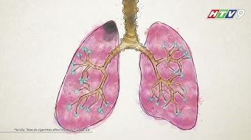 🚭🚭🚭 PHÓNG SỰ HTV : TÁC HẠI THUỐC LÁ ĐỐI VỚI CON NGƯỜI ĐẶC BIỆT LÀ THUỐC LÁ ĐIỆN TỬ 🚭🚭🚭