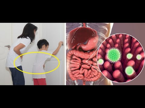 Wideo: Wymioty i biegunka u dzieci bez gorączki: leczenie