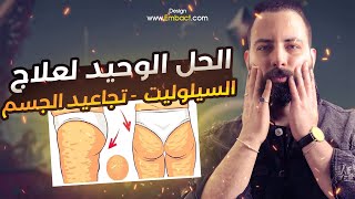 علاج السيلوليت ( تجاعيد الجسم ) بدون ادويه او كريمات صدقني شكل جسمك هيتغير