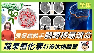 龐建國 大腸癌 纏身 生前嘆生不如死！ 原發癌棘手 腦轉移 最致命！ 植化素 阻斷癌細胞血管增生 ！ 天然食物 防癌健康煮 ！ 健康2.0 20220206 (完整版)