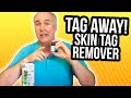 Skin Tag Remover- Tag Away