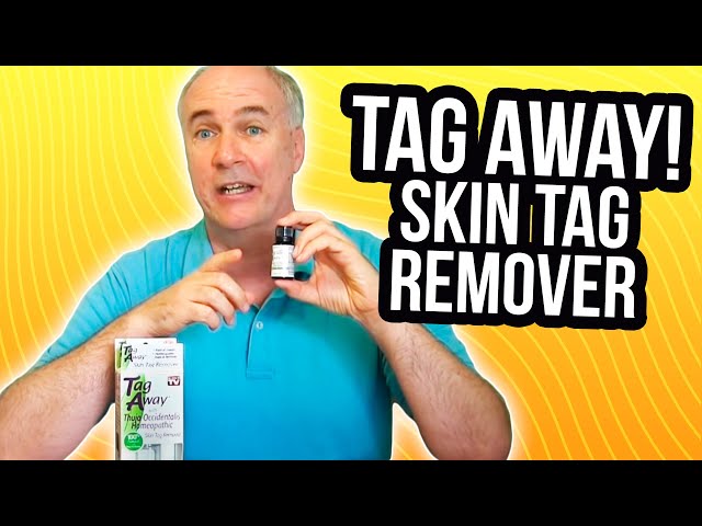 Live - Introducing OPHERA Skin Tag Remover: How to Use and