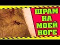 МГНОВЕННАЯ КАРМА - ЧУТЬ НЕ ОТРЕЗАЛО НОГУ (СЛУЧАЙ ИЗ ЖИЗНИ)