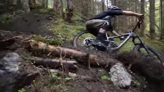 Guy Took A Terrible Fall Coming Down On His Mountain Bike