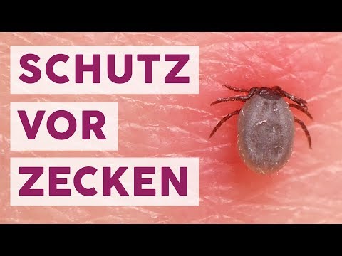 Video: Muss ich mir wegen Zecken Sorgen machen?