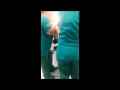 Φυσιολογικός τοκετός  - δευτεροτόκος, εξωσωματική γονιμοποίηση
