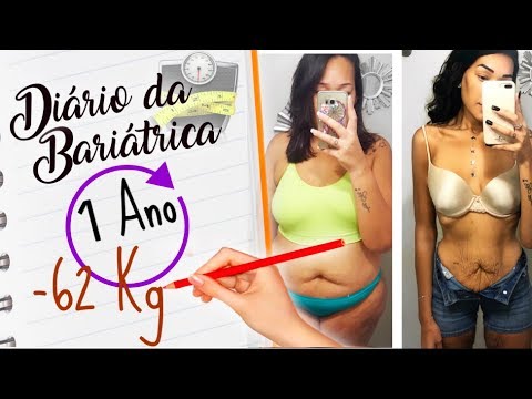 Diario da Bariatrica | 1 ano | 62Kg | UPDATE | Flacidez