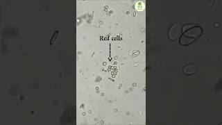 Urine Examination 🧪 – Rog Nidan Practical. #biology #ayurved #microscope #rbc #urine