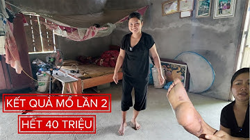 KẾT QUẢ BẤT NGỜ CHỊ DÂU SÍNH 1 CHÂN MỔ LẠI LẦN 2 HẾT 40TR VÀ CÁI KẾT . PHENG PHENG VLOG