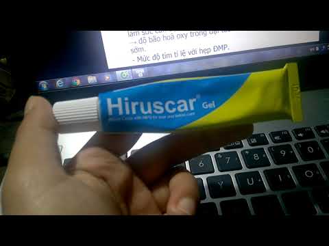 review hiruscar ,kết quả trị sẹo lõm và thâm với hiruscar sau 2,5 tháng ,quá bất ngờ