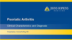 Psoriatic Arthritis : Clinical Characteristics and Diagnosis