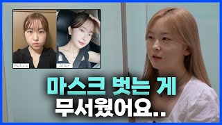 [JP]안면비대칭 양악수술 사례, &quot;교정하러 치과 갔는데 수술 케이스라네요&quot;