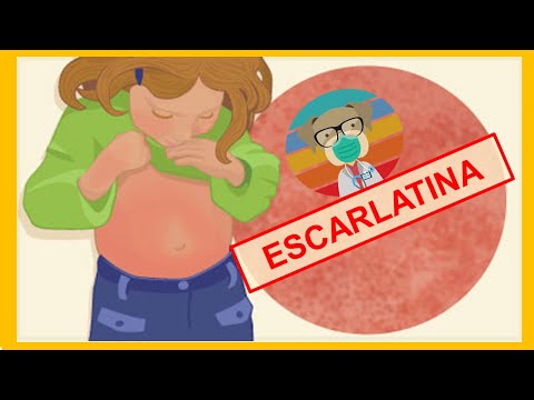 🔴 ESCARLATINA- Causa, fisiopatología, signos, síntomas y tratamiento