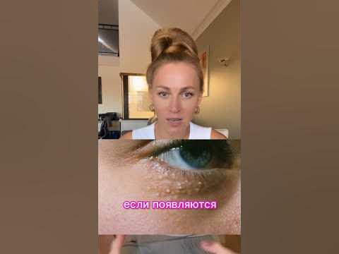 Жировики вокруг глаз? Милиумы вокруг глаз - YouTube