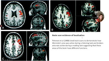 Evaluation of localisation of brain function