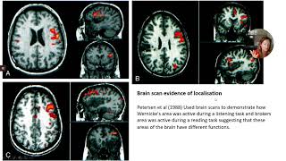 Evaluation of localisation of brain function