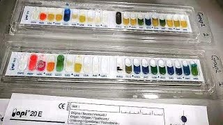 How to perform API 20E 🇪🇸 Biochemical tests for identifying microorganisms
