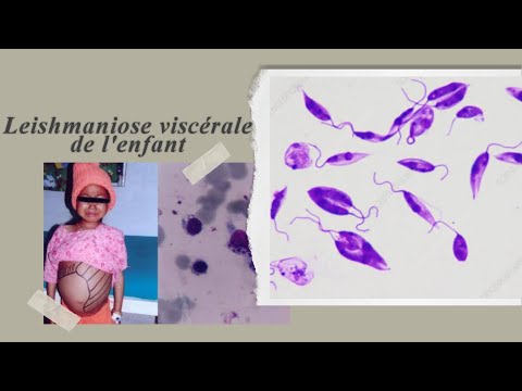 Vidéo: Effet Des Inhibiteurs De La Phospholipase A 2 Lors D'une Infection Causée Par Leishmania (Leishmania) Amazonensis