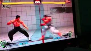 Ryu option selects