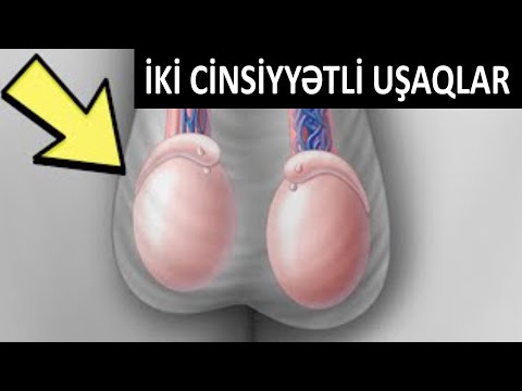 Video: Əkizlər genetik olaraq eynidirmi?