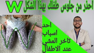 w shape sitting جلوس الاطفال بشكل خاطئ يؤثر علي النمو