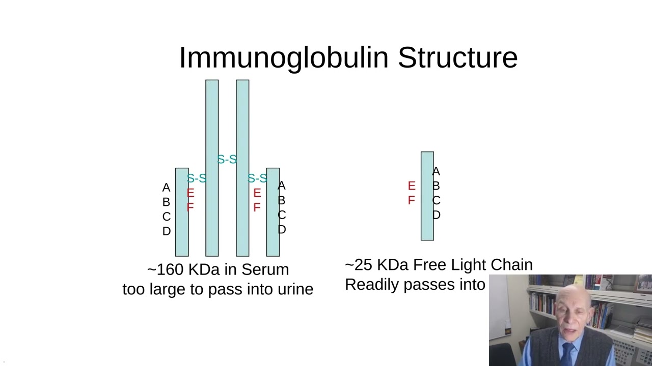 CAP Guidelines for Laboratory Detection and Initial Diagnosis of Monoclonal  Gammopathies