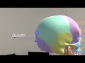 Skull demo in hololens