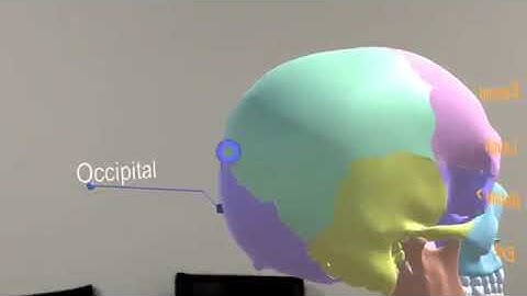 Skull Demo in HoloLens
