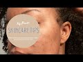 Skincare Tips to Help with Acne and Post-Inflammatory Hyperpigmentation