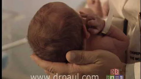 HANDLING BABY's HEAD- FONTANELLES-SOFT SPOTS-www.drpaul.com