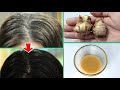 40 Years Old White Hair To Black Hair Naturally Works At Home