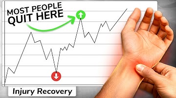 Why Most People Give Up on RSI Recovery—And How to Push Through