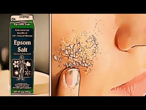 How To Use Epsom Salt To Treat These Common Health Issues
